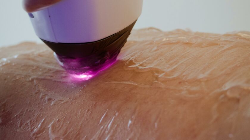 depilacja laserowa Radom