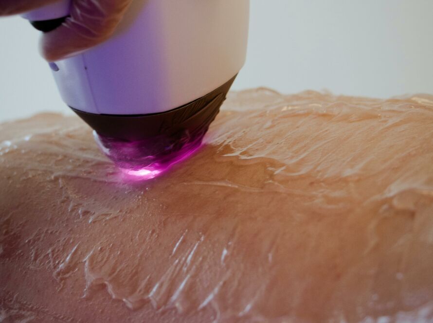 depilacja laserowa Radom